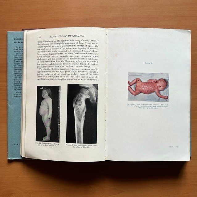 Diseases of Infancy and Childhood  -  Sir Wilfrid Sheldon image 7