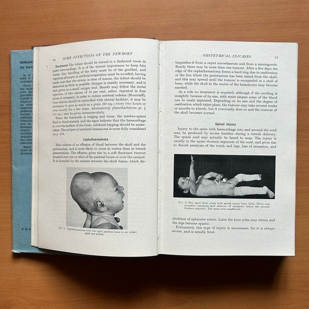 Diseases of Infancy and Childhood  -  Sir Wilfrid Sheldon image 5