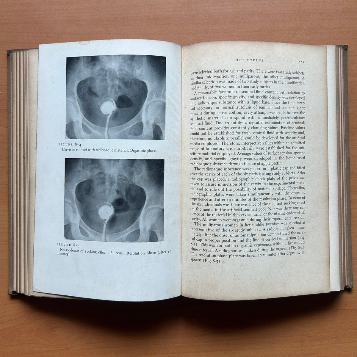 Human Sexual Response  -  William H. Masters - Virginia E. Johnson image 8