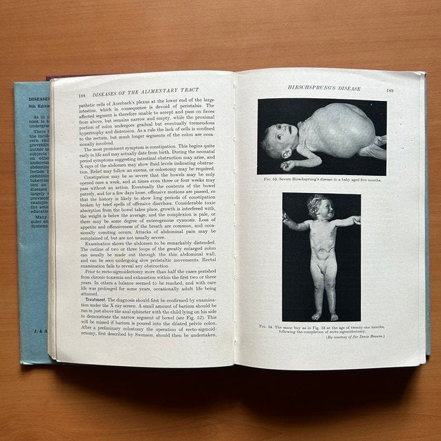 Diseases of Infancy and Childhood  -  Sir Wilfrid Sheldon image 8