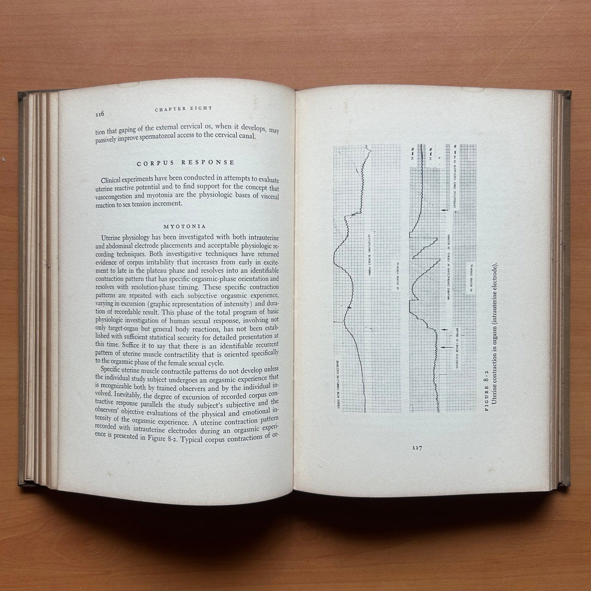 Human Sexual Response  -  William H. Masters - Virginia E. Johnson image 6
